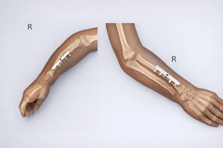 В детской краевой больнице выполнили уникальную операцию